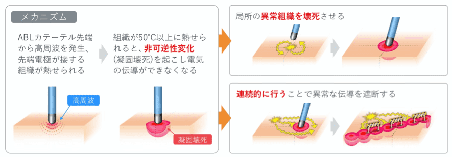 勃起不全トルコ語anlami